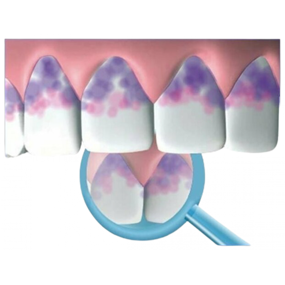 Индикация налета. Мирадент индикатор зубного. Индикатор зубного налета Miradent. Жидкость для индикации зубного налета. Индикатор зубного налета Plaque agent.